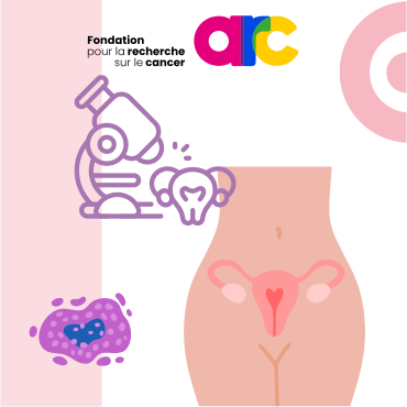 Image Cancer du col de l’utérus, du nouveau pour anticiper le pronostic et la réponse aux immunothérapies