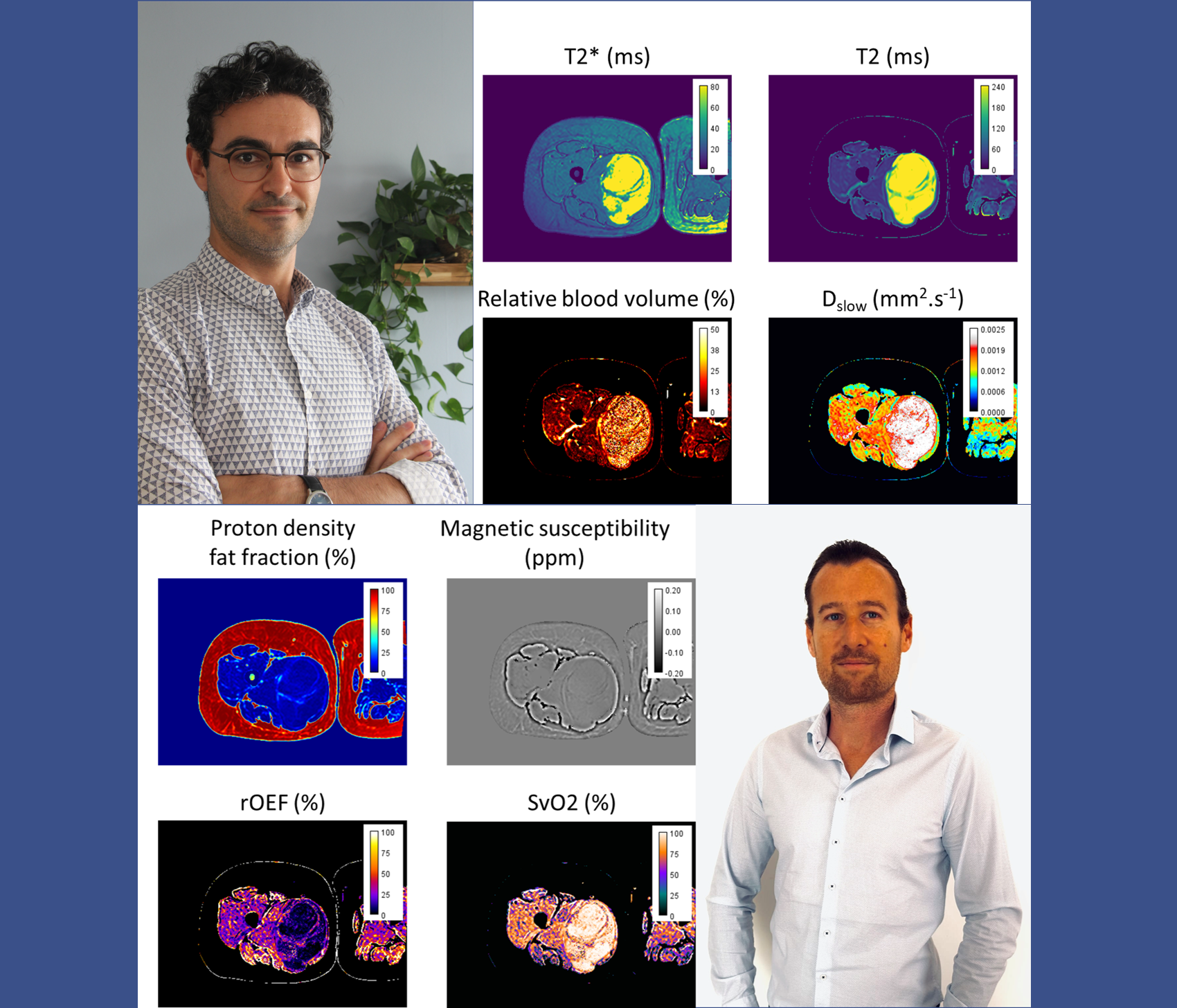 Image Exemple de cartographies quantitatives obtenues durant le projet SarQuantIRM, piloté par Dr Benoît Allignet et Benjamin Leporq