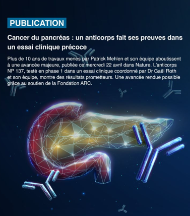 Image Cancer du pancréas : un anticorps fait ses preuves dans un essai clinique